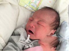 �����Ⱦɫ���쳣�Թܵ���' /></a></div>
		<div class=